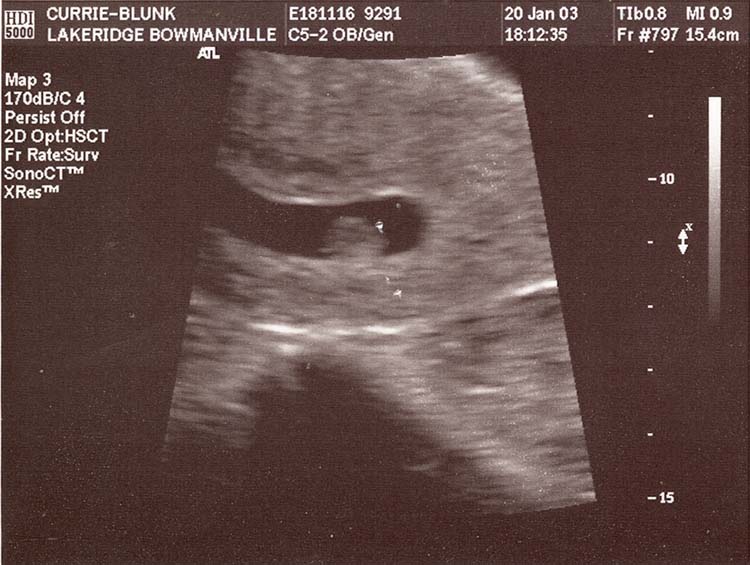 1-Ultrasound